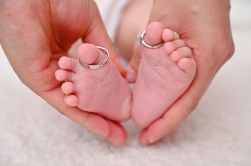 衡水孕妇怎样预防妊娠纹